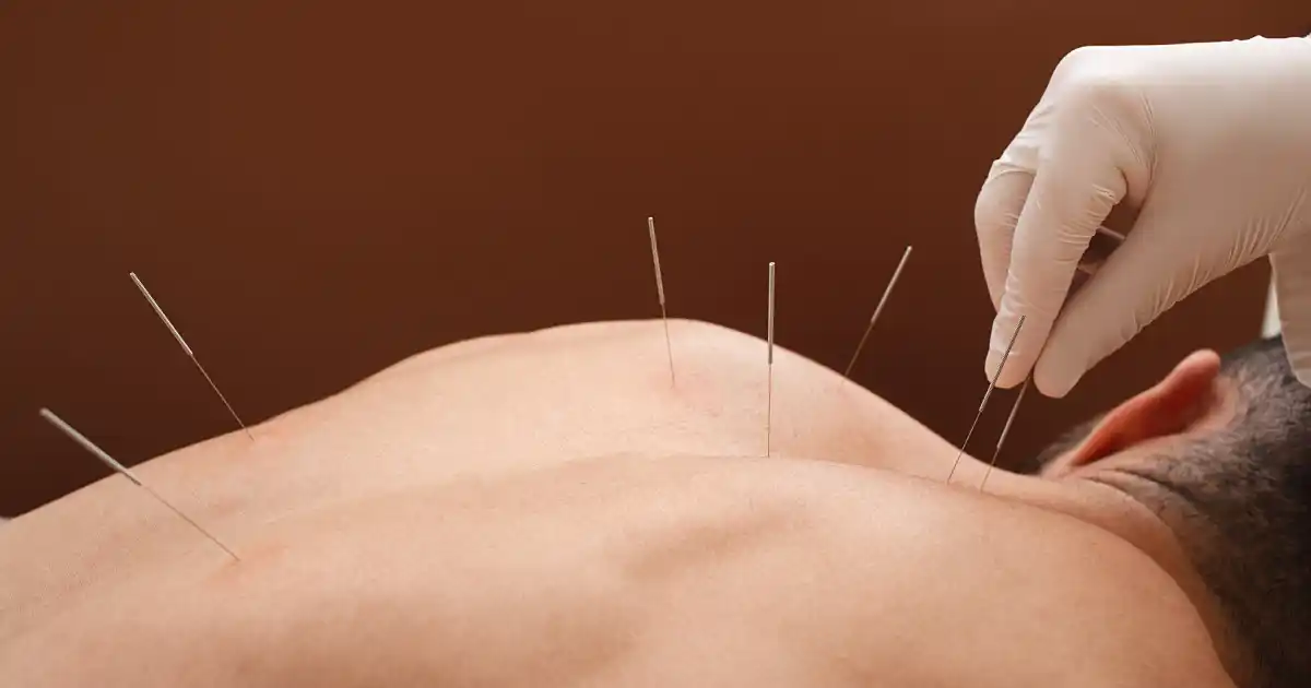 Acupuncture Supports Digestive Health in Fairfax, VA