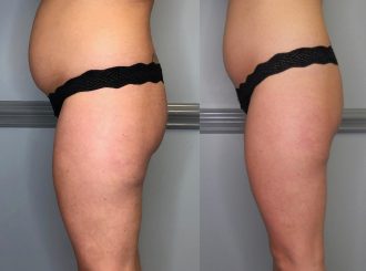 mygentlewellness-slimmings-toning-treatments-give-credit-to-@tnhydration